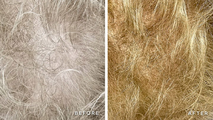 XTRESSE Hair Growth Gummy Before & After